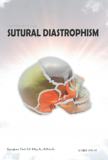 SUTURAL DIASTROPHISM